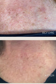 Tronque Exfoliating Body Serum - 100ML